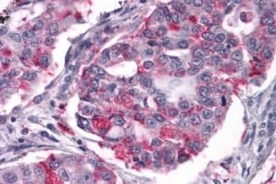 Immunohistochemistry: NPY2R Antibody [NBP3-14425]